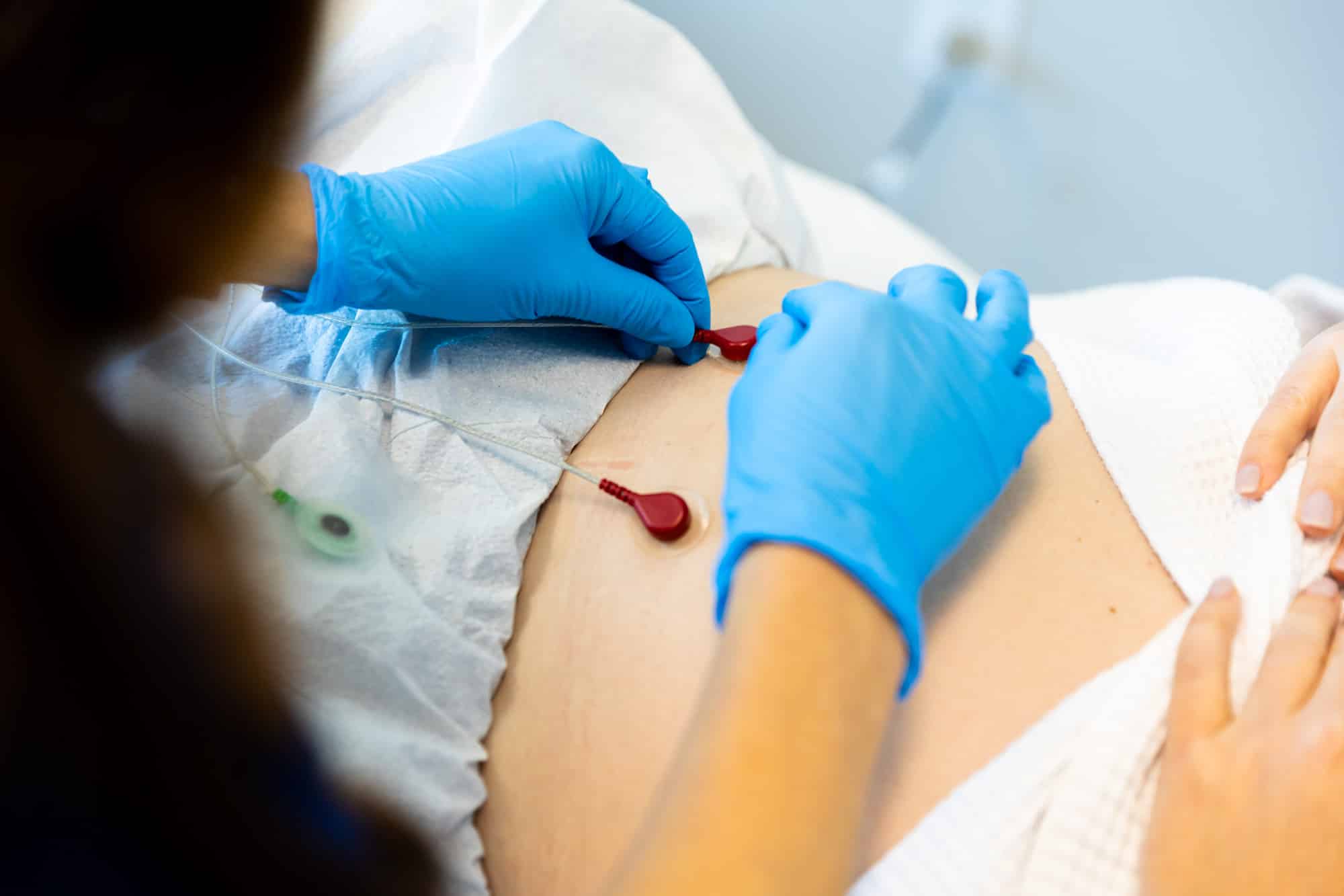 Pelvic Floor Muscle Training