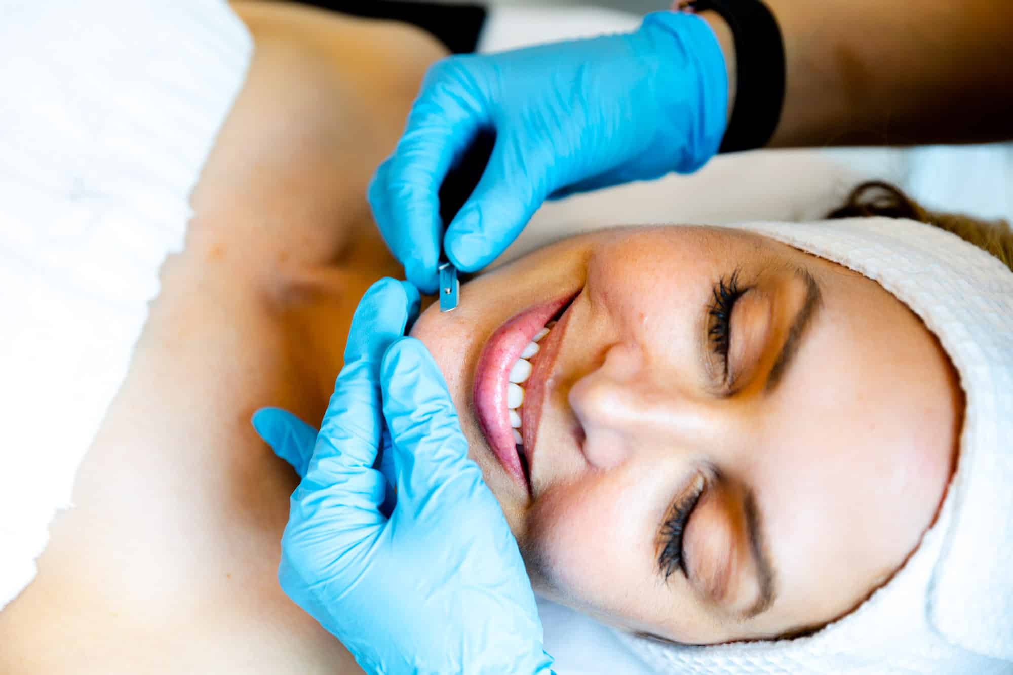 Dermaplaning a lovely woman's face to show what is dermaplaning in Houston, TX