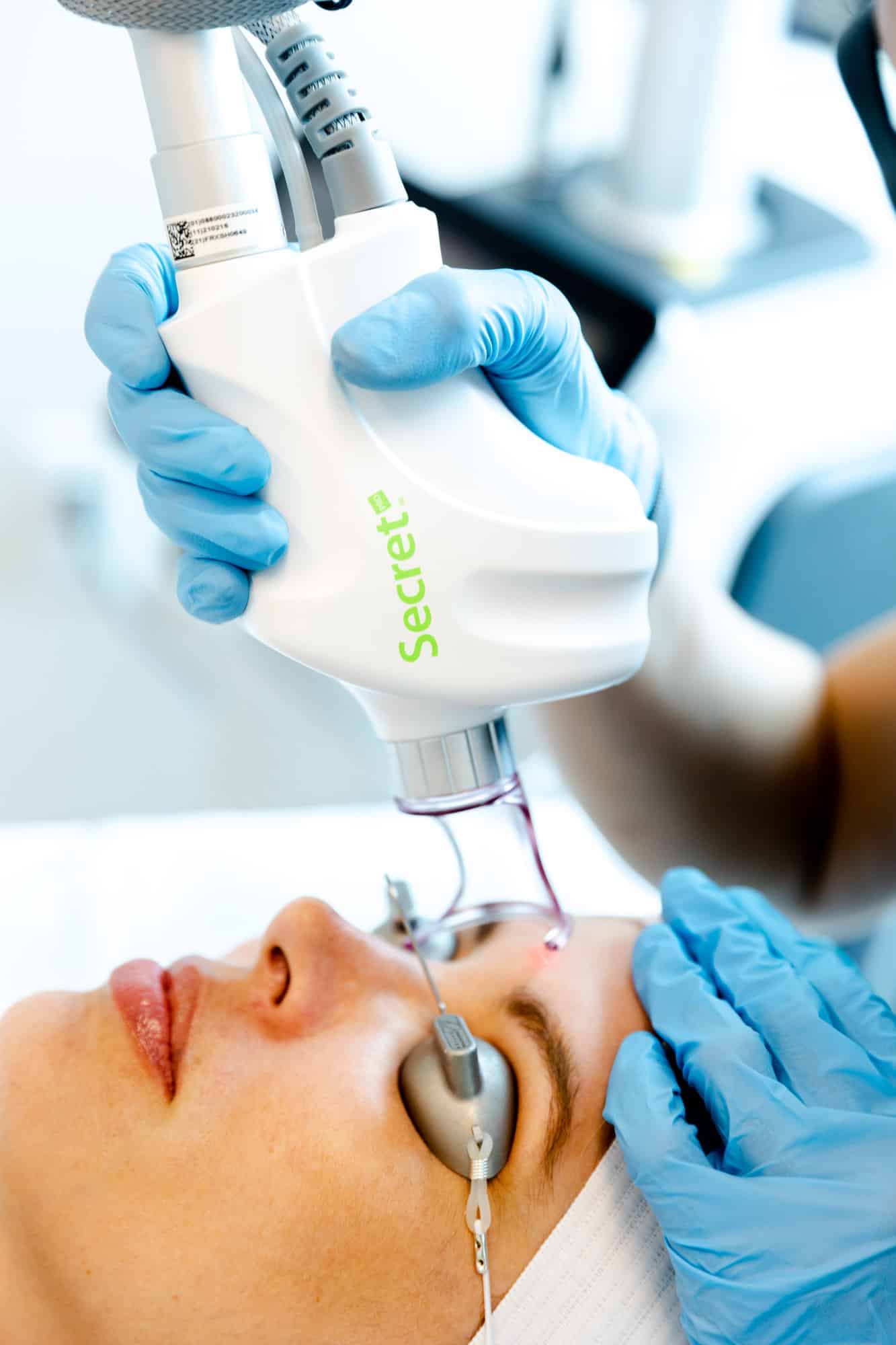 action shot of lovely young woman receiving secret rf pro as rf microneedling in houston tx