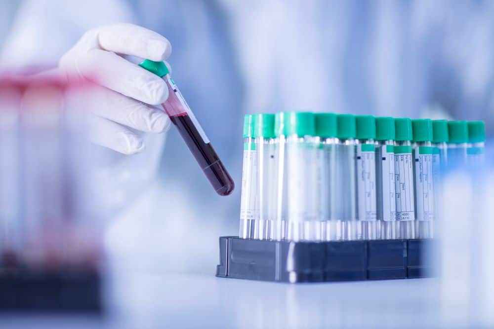 test tubes in laboratory with blood sample representing micronutrient testing in houston tx