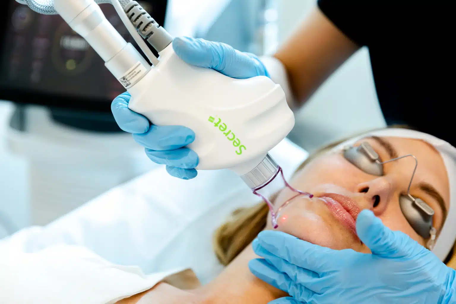 ChristiMD-Secret-6171-1536×1024 Secret RF skin tightening in Houston