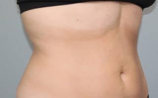Trusculpt ID