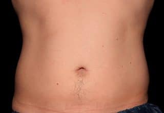 Trusculpt ID