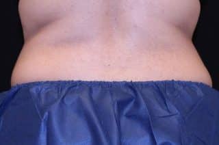 Trusculpt ID