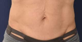 Trusculpt ID