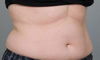 Trusculpt ID