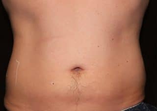 Trusculpt ID