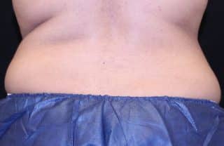 Trusculpt ID