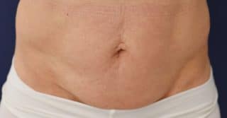 Trusculpt ID